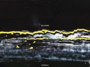 Gilla Band – Pugnello